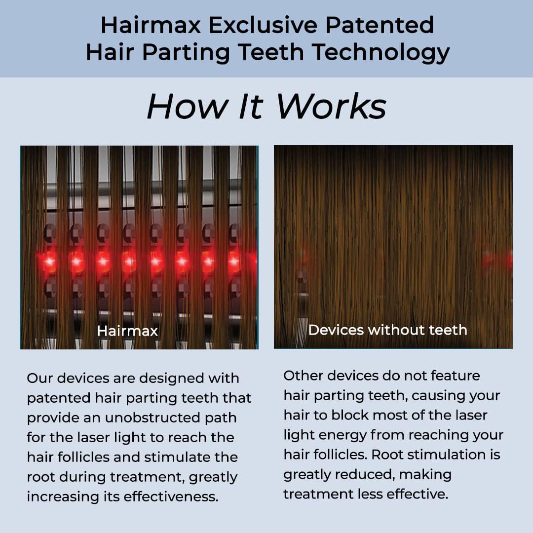 HairMax Ultima 12 Classic LaserComb – FDA-Cleared Hair Growth Device for Men & Women