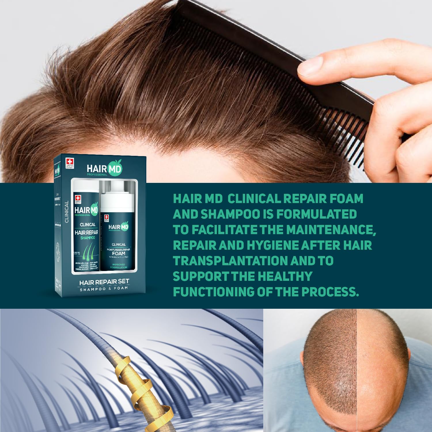HairMD Transplant Hair Repair Set – Post-Transplant Shampoo & Moisturizing Foam