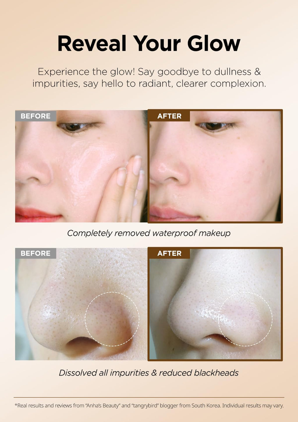 Hanskin BHA Pore Cleansing Balm – Korean Melting Cleanser for Oily & Combination Skin