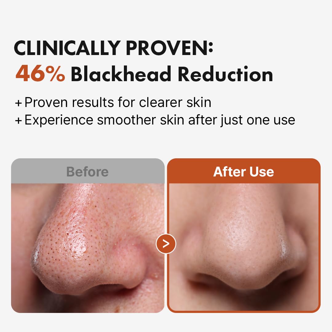 Hanskin BHA Pore Cleansing Oil – Gentle Cleanser for Oily & Combination Skin (10.14 oz)