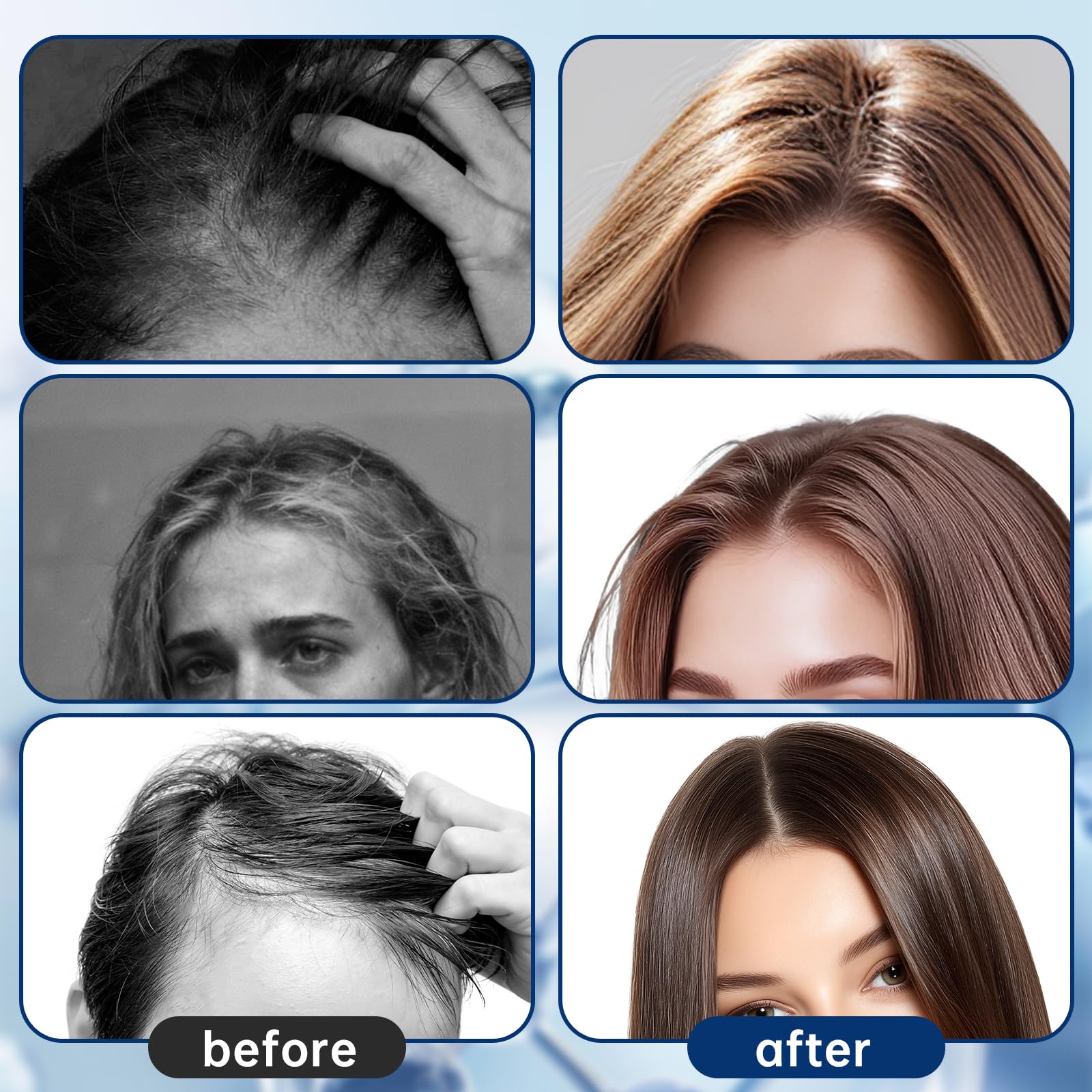HASCURI 5-in-1 Hair Growth Serum Roll-On – DHT Blocker with Rosemary, Redensyl, Anagain, Ginger & Batana Oil