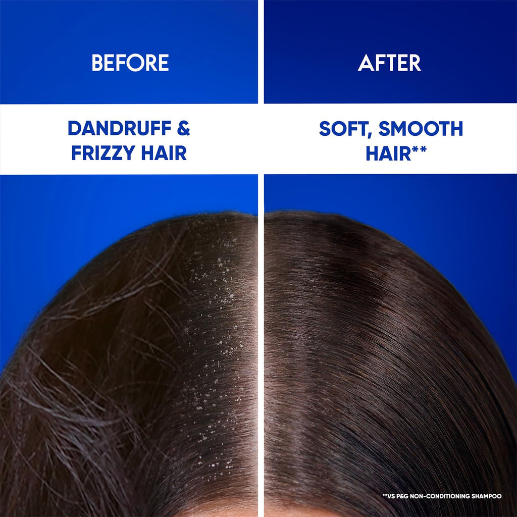 Head & Shoulders Smooth & Silky 2-in-1 Shampoo + Conditioner (180ml)