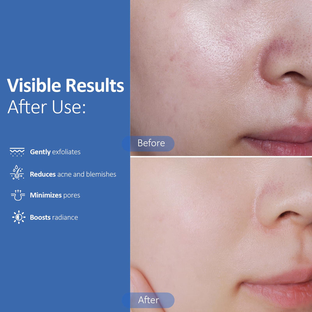 Hicream Glycolic Acid Exfoliating Pads | Dual-Texture Toner for Pore Care & Radiance
