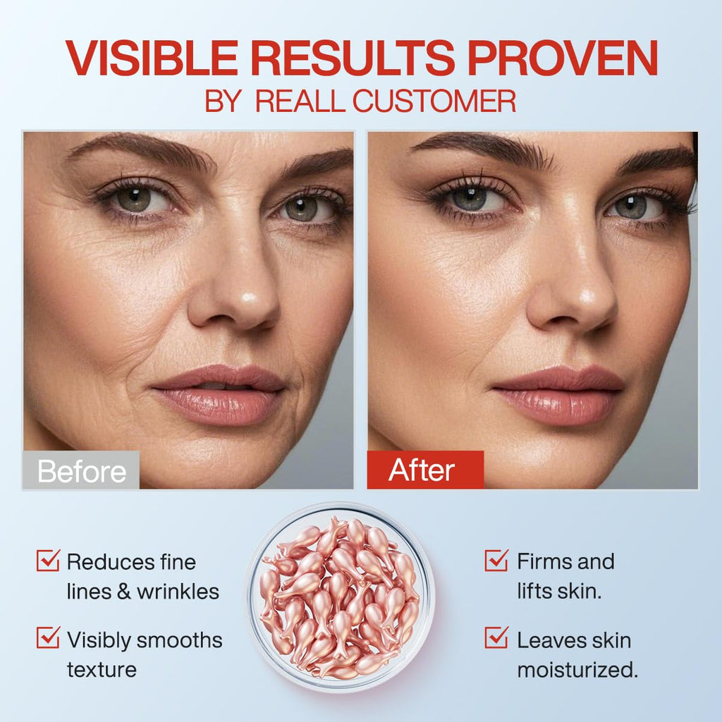 HKH Retinol Serum Capsules for Face – Anti-Aging Vitamin A & E (38 Caps), Travel-Friendly