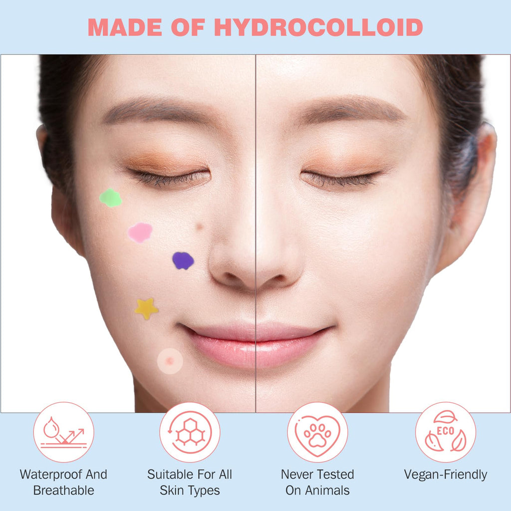 HLOES Pimple Patches – Cute Star-Shaped Hydrocolloid Patches, 280 PCS, Overnight Blemish Coverage