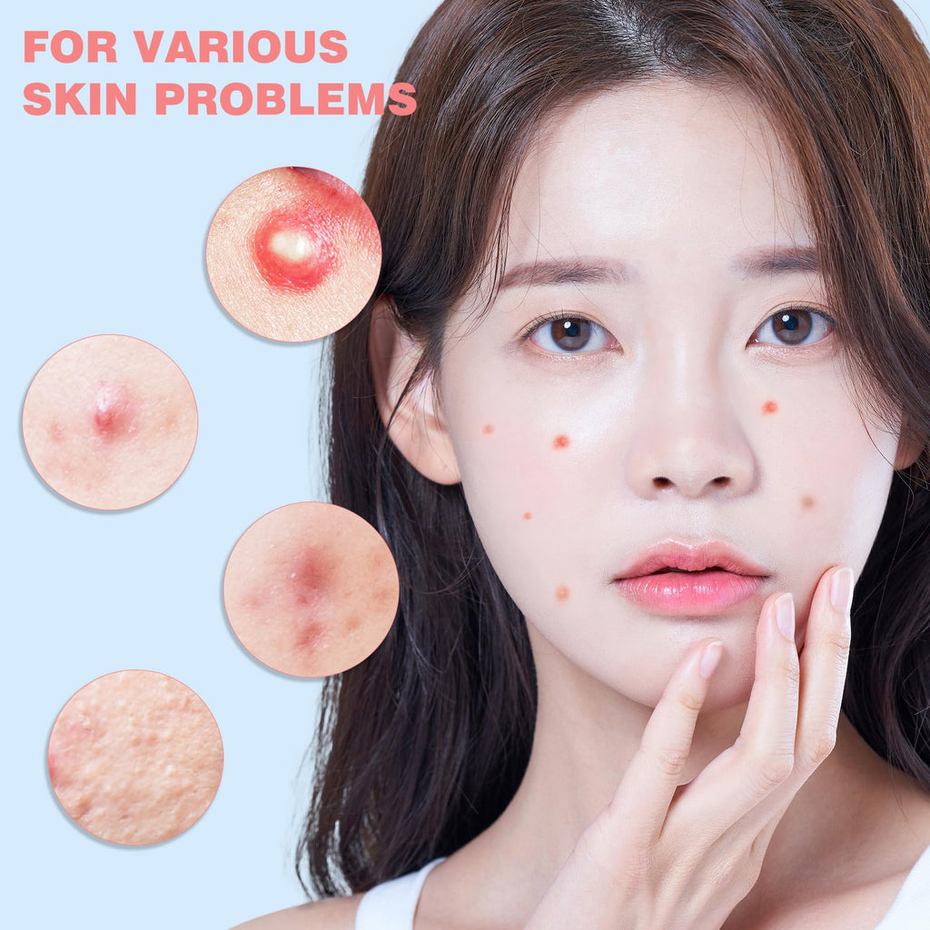 HLOES Pimple Patches – Cute Star-Shaped Hydrocolloid Patches, 280 PCS, Overnight Blemish Coverage