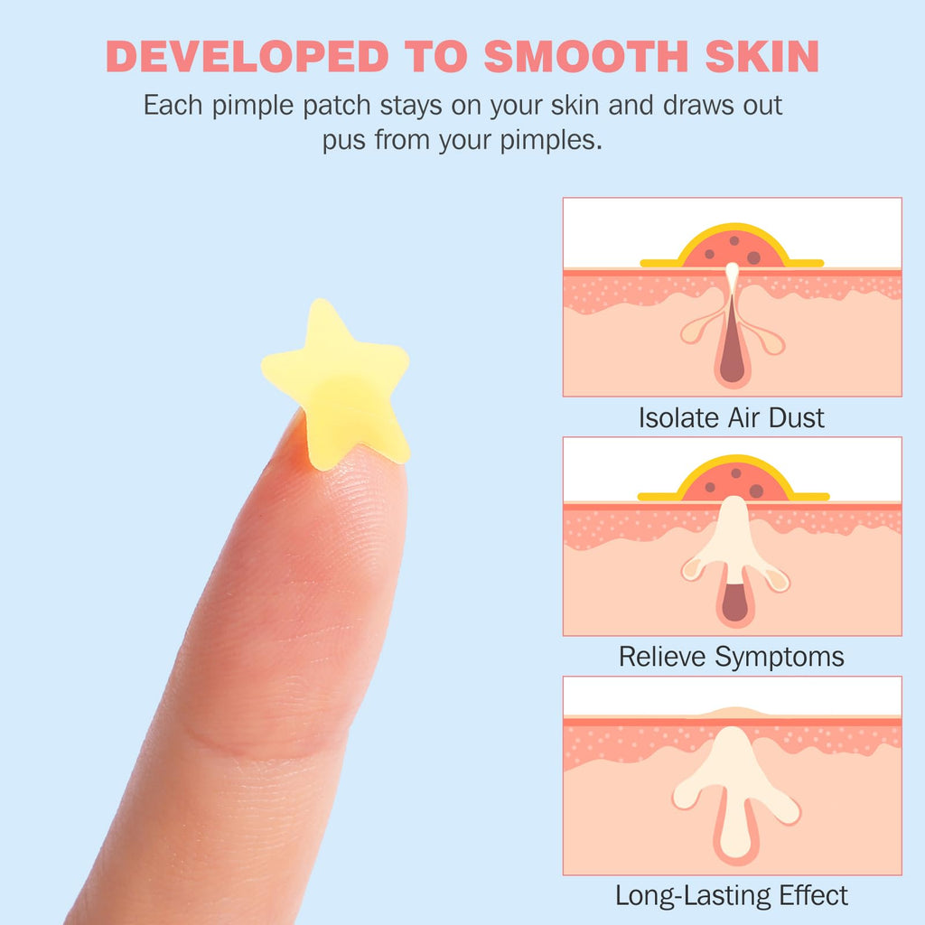 HLOES Pimple Patches – Cute Star-Shaped Hydrocolloid Patches, 280 PCS, Overnight Blemish Coverage