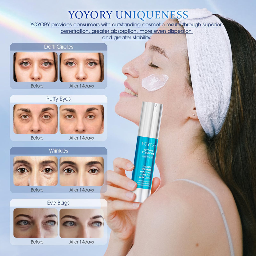 HOLYOM Retinol Under Eye Cream – Anti-Aging for Dark Circles, Puffiness & Fine Lines | Hydration (1 fl oz)