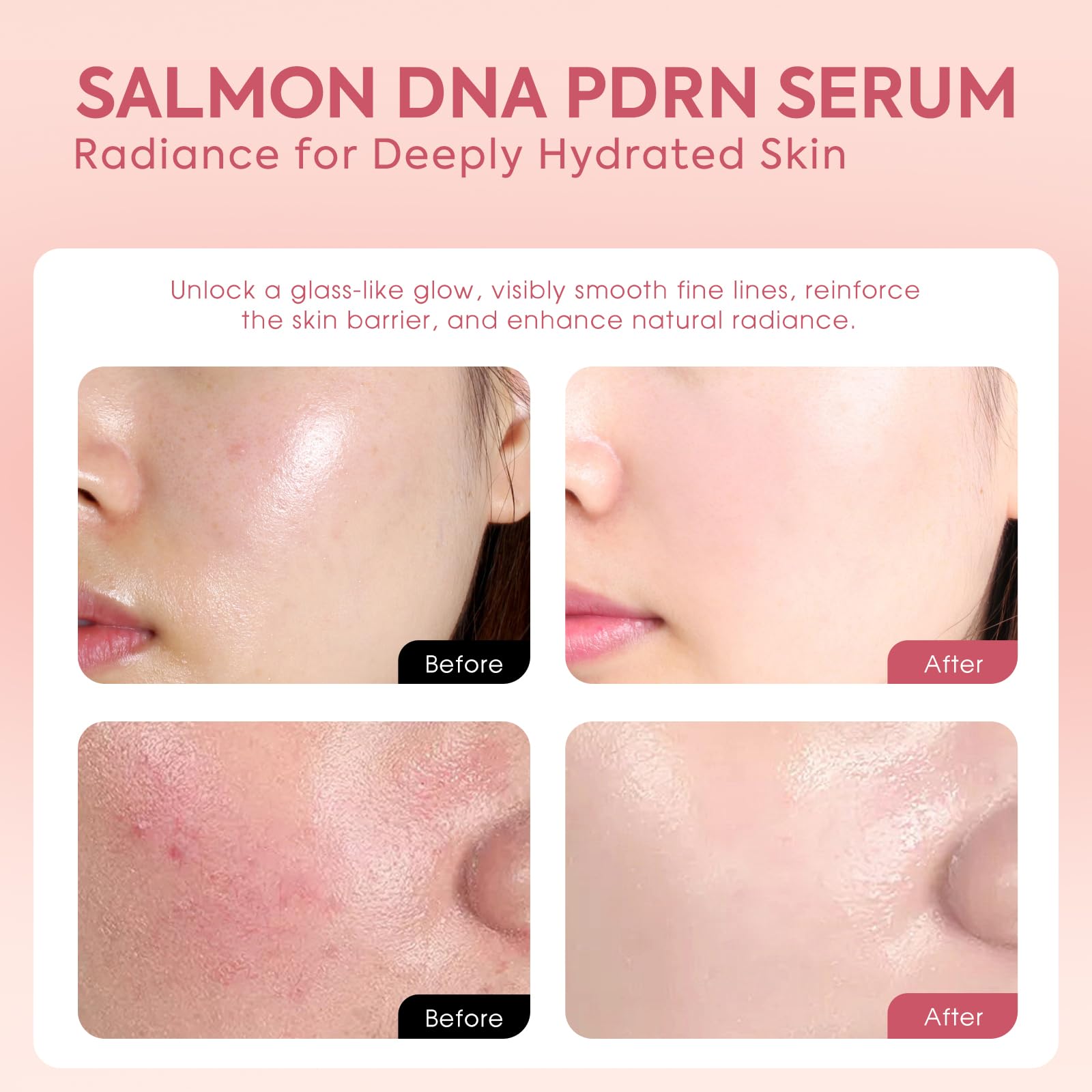 House of Nutrition Salmon DNA Serum – 99% PDRN High-Purity Ampoule for Deep Hydration