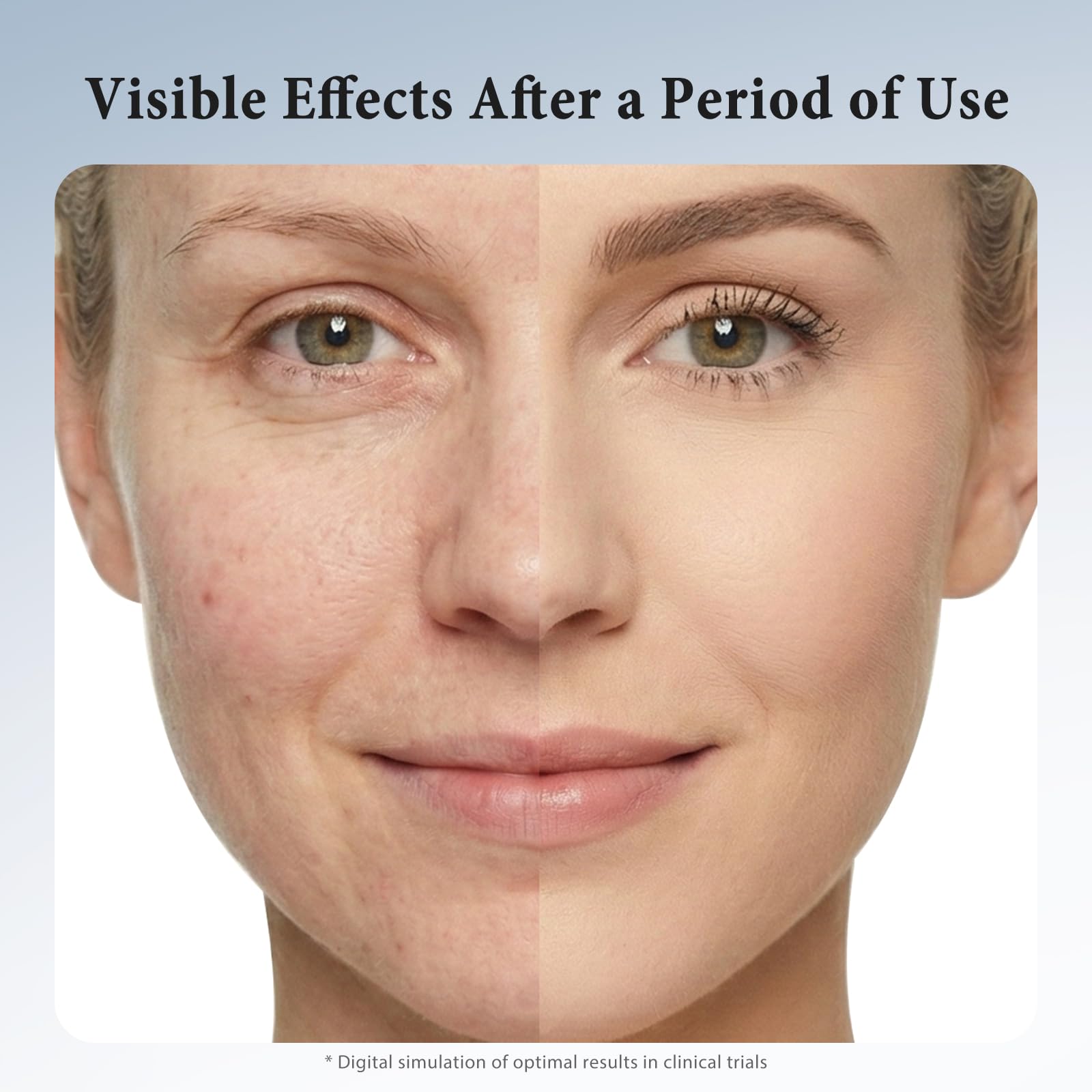 Hyuxeo Retinol Serum for Face – Deep Hydration & Anti-Aging (All Skin Types, 1.7 fl oz)