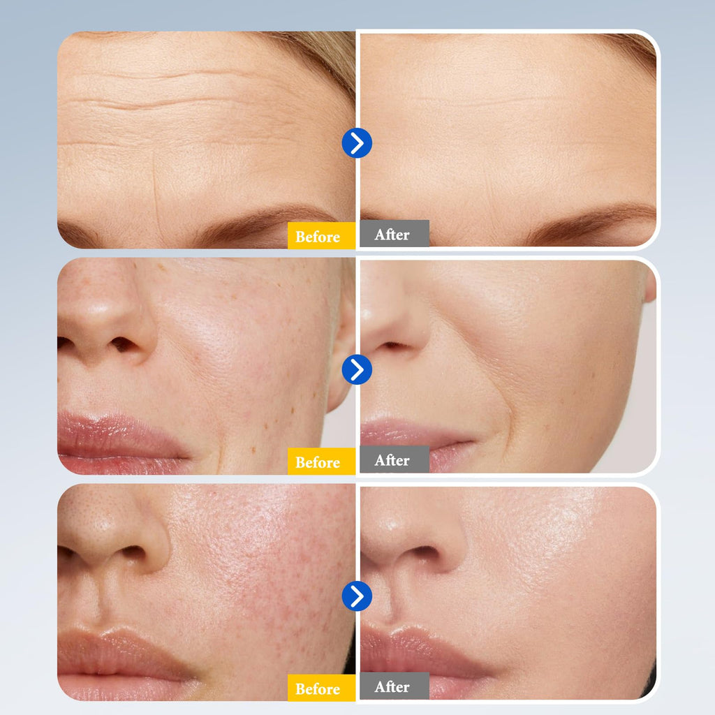 Hyuxeo Retinol Serum for Face – Deep Hydration & Anti-Aging (All Skin Types, 1.7 fl oz)