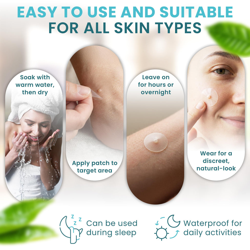 ICYVIBES Premium Cosmetic Adhesive Patches – Waterproof & Invisible