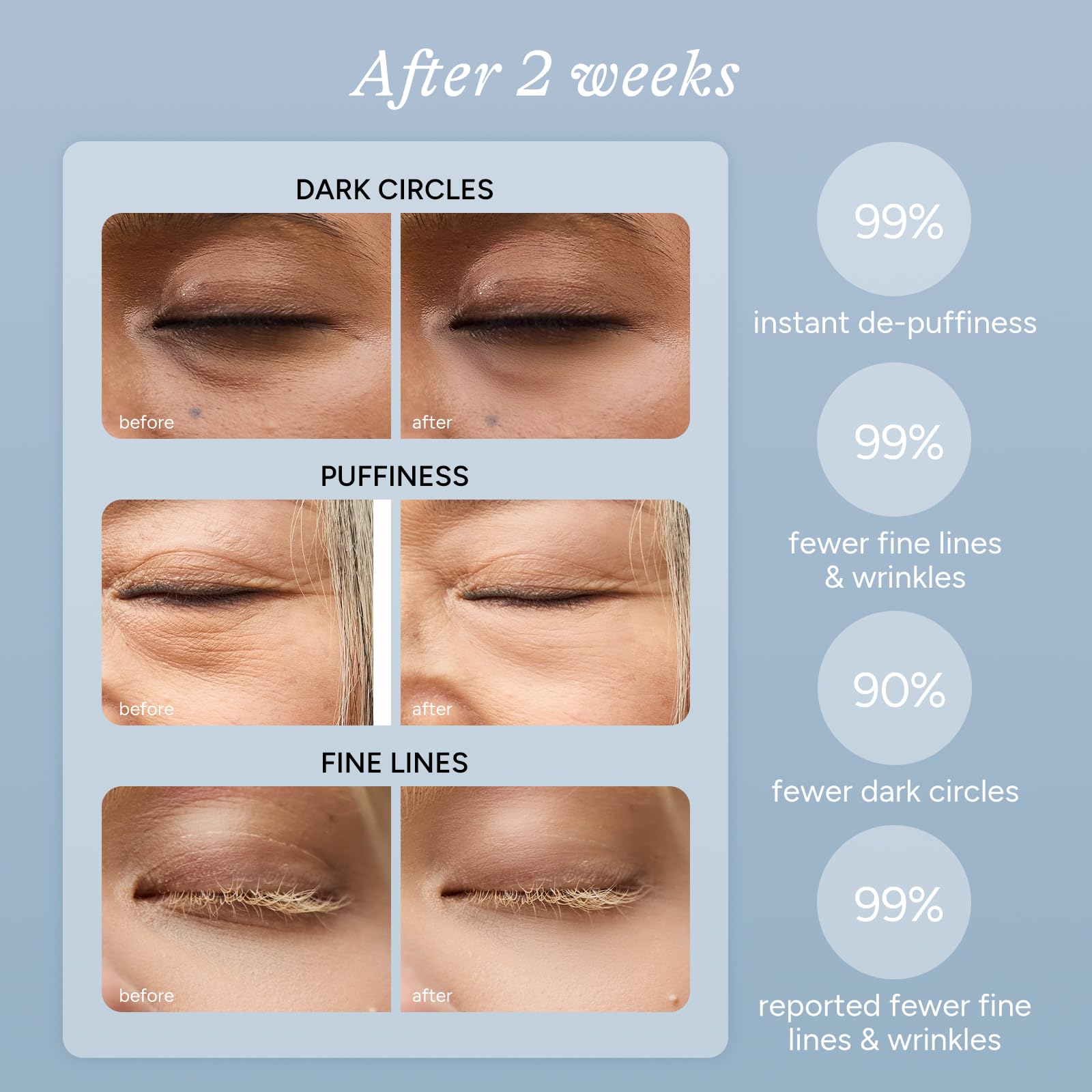 In My Eyes Caffeine & Hyaluronic Under Eye Patches PRO – 5 Pairs | 360° Coverage