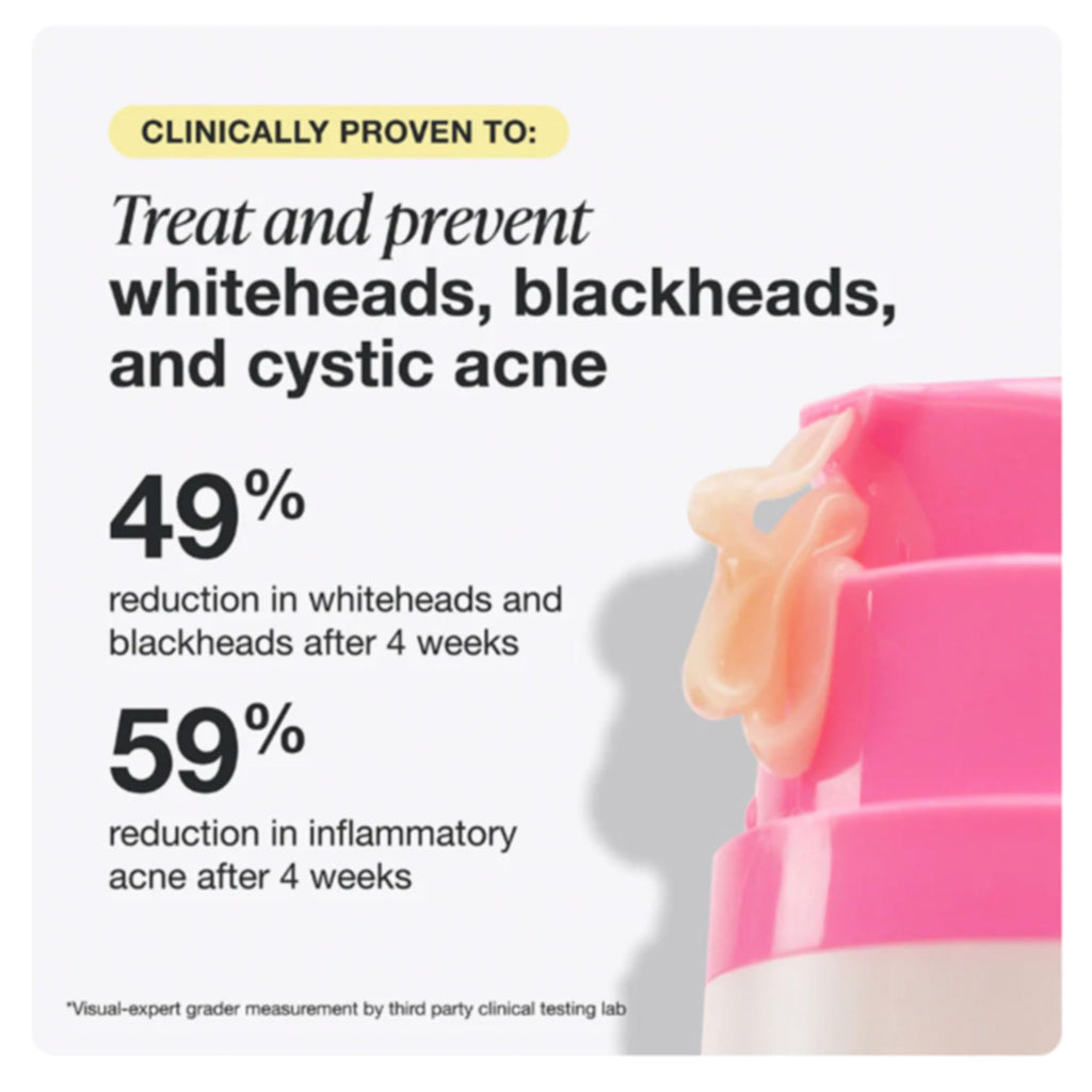 INNBEAUTY Project Acne Serum | Medicated Acne Treatment for Breakouts & Oil Control | 1 oz