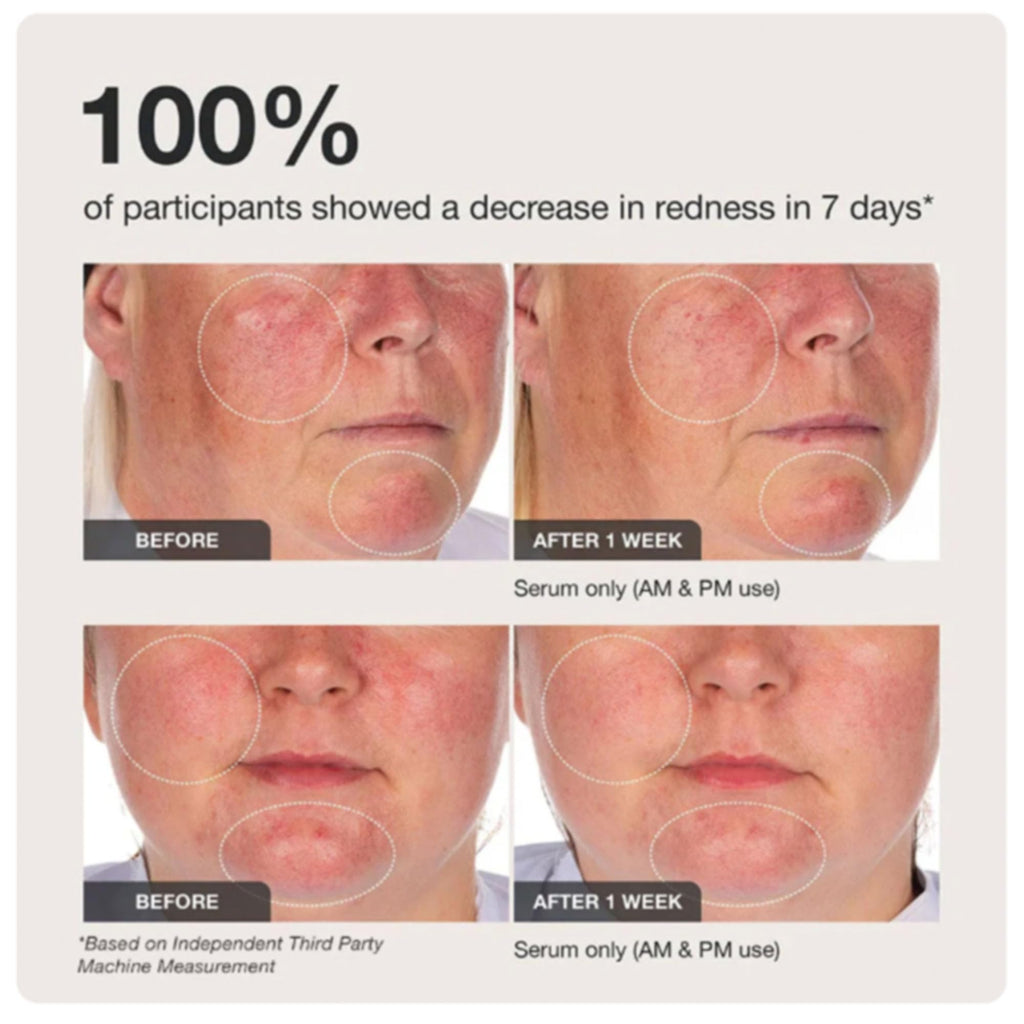 Innbeauty Project Calm the Red Down Dual-Chamber Serum for Redness & Skin Barrier Support – 1.7 oz