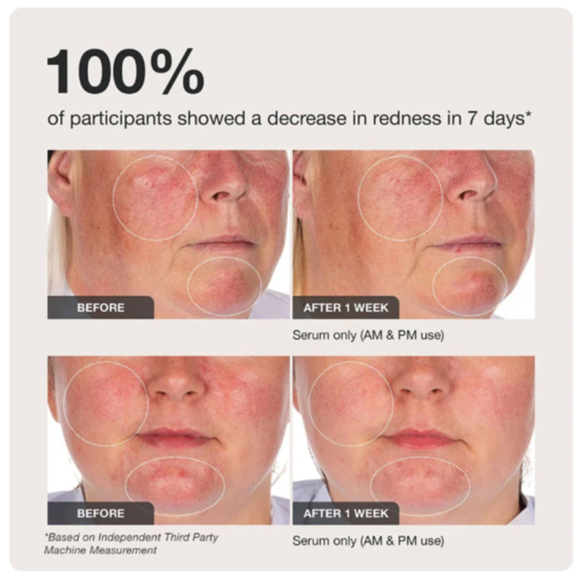 Innbeauty Project Calm the Red Down Dual-Chamber Serum for Redness & Skin Barrier Support – 1.7 oz