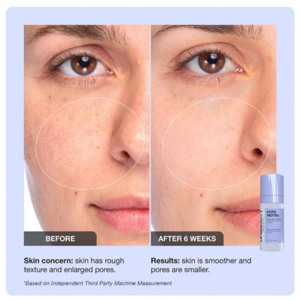INNBEAUTY Project Pore Refine Serum – Pore Tightening & Texture Smoothing, 1 oz