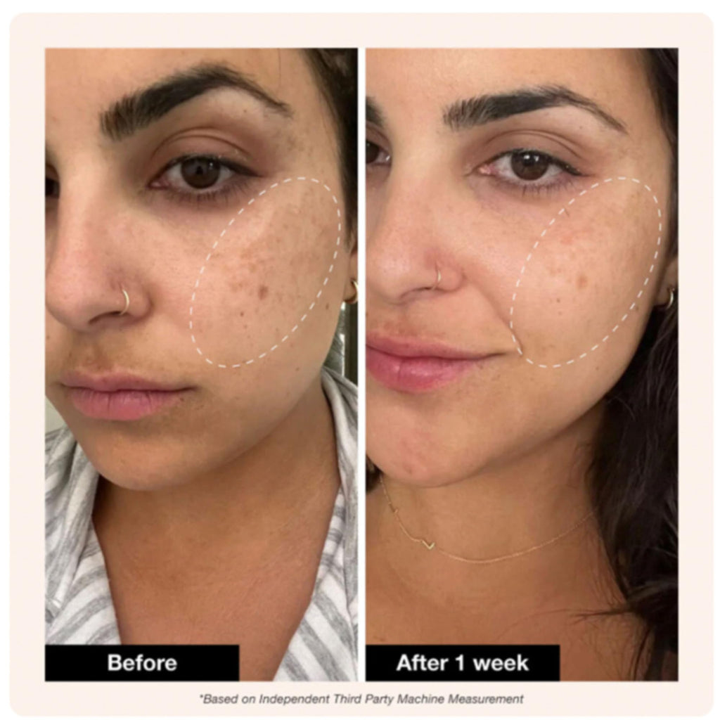 Innbeauty Project Retinol Remix 1% Retinol Treatment with Peptides & Tranexamic Acid | Wrinkles & Texture