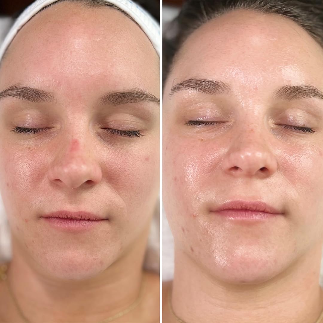 Intraceuticals Rejuvenate Daily Serum – Deep Hydration, Radiance & Makeup Prep