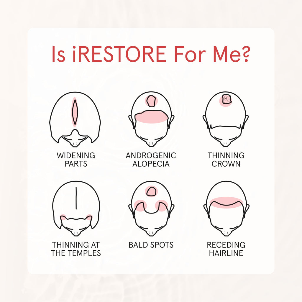 iRestore Biotin Hair Conditioner for Damaged Dry Hair – Volumizing & Strengthening for Fine Hair