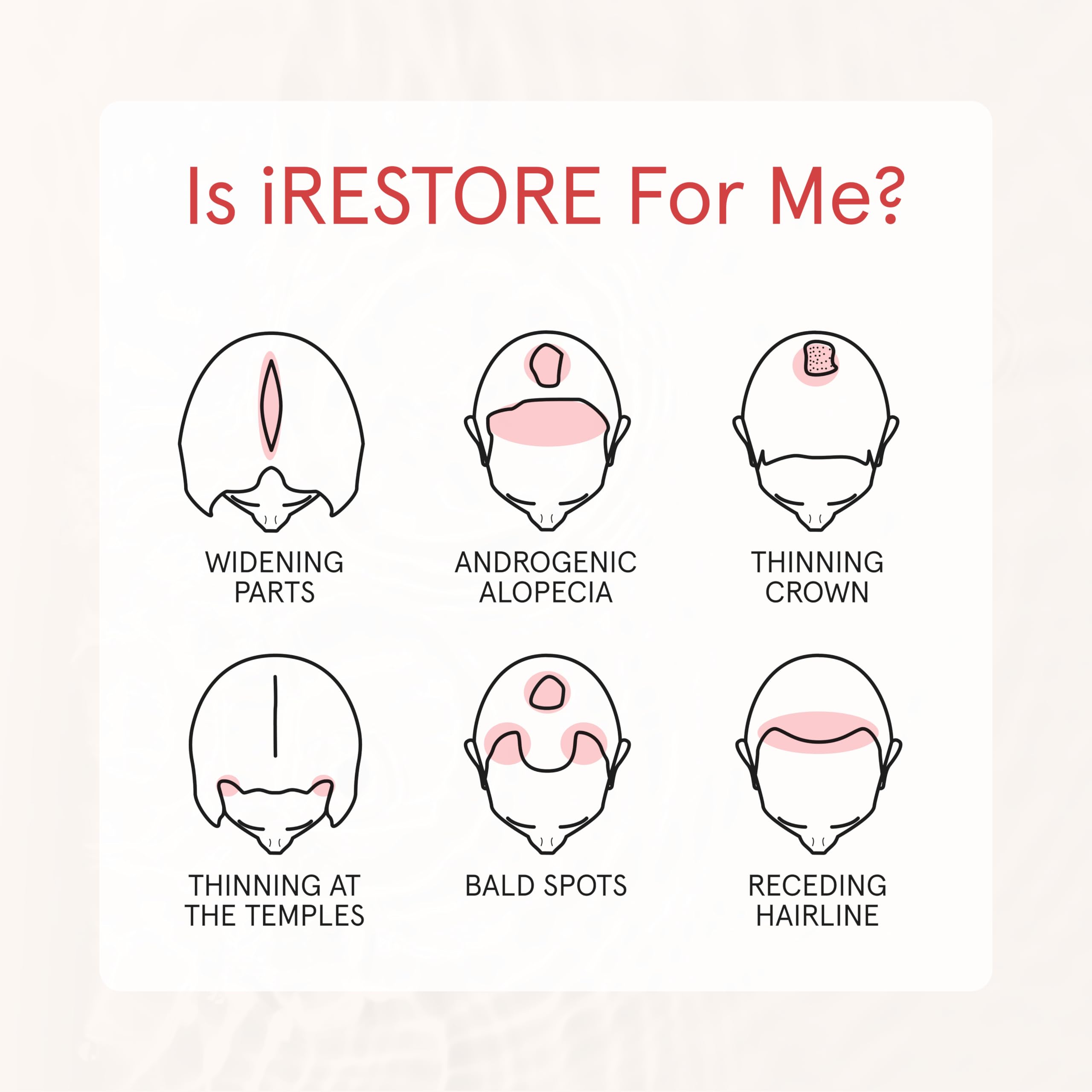 iRestore Biotin Hair Conditioner for Damaged Dry Hair – Volumizing & Strengthening for Fine Hair