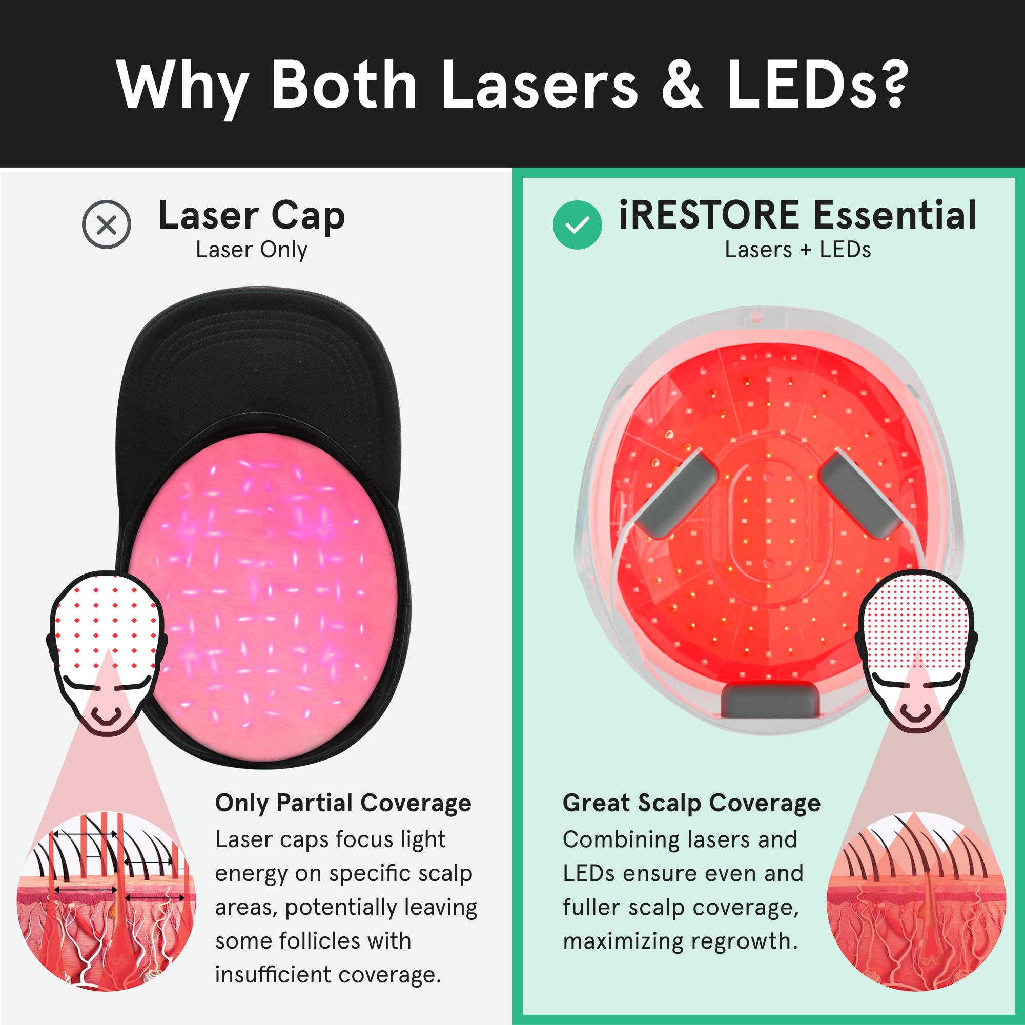 iRestore Essential Laser Hair Growth System + Rechargeable Battery Pack | FDA Cleared