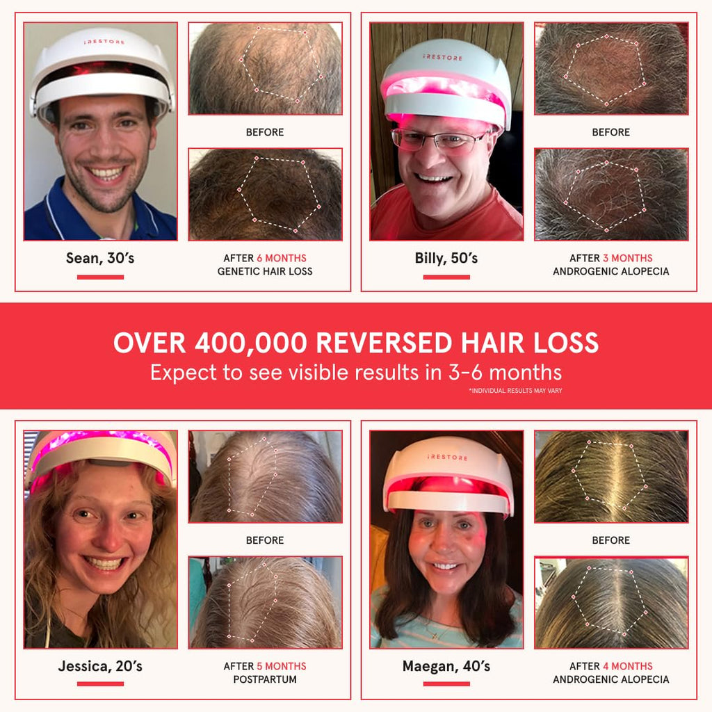 iRestore Essential Laser Hair Growth System – FDA-Cleared Hair Loss & Thinning Treatment for Men & Women