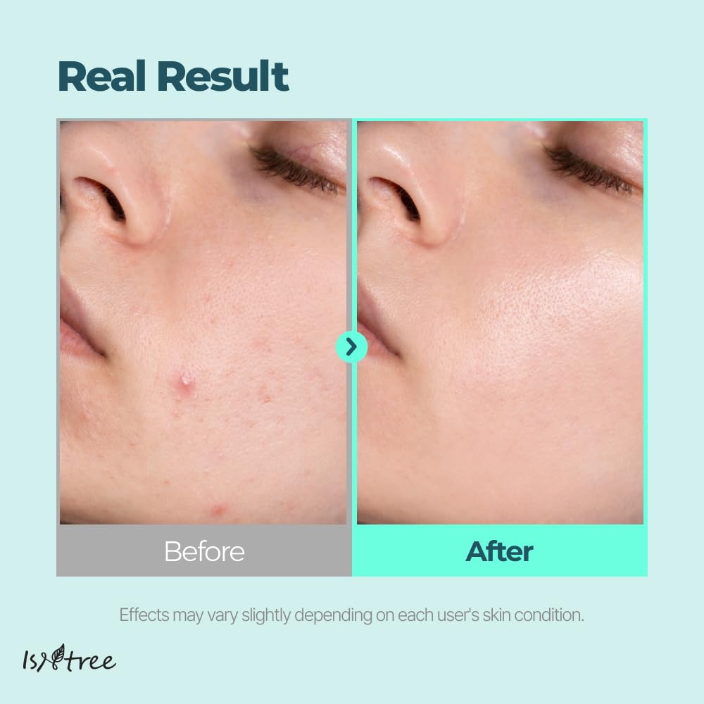 IsNtree Gim PDRN Deep Sleep Mask 80ml – Seaweed PDRN Night Gel for Hydration & Skin Bounce