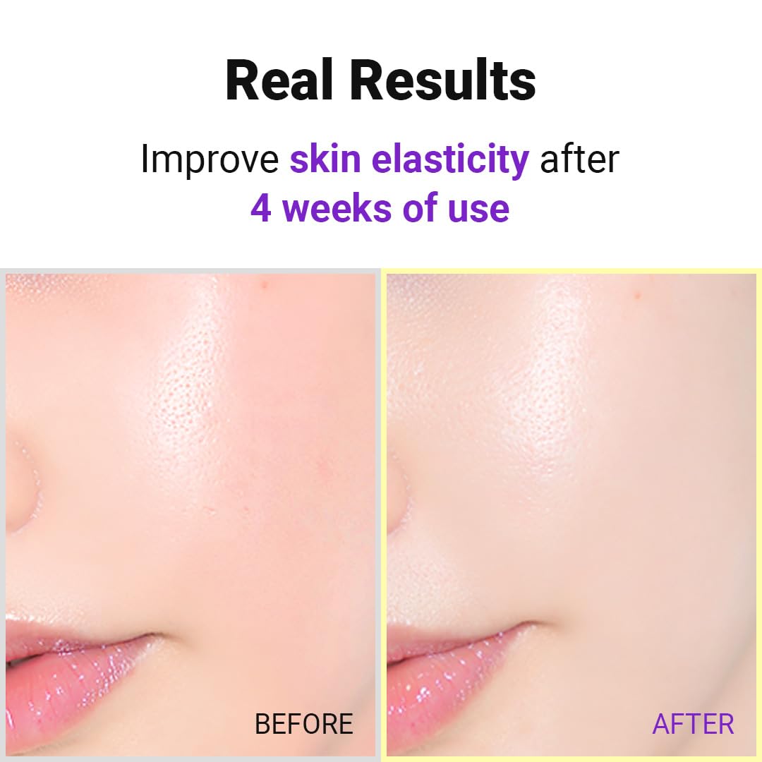 ISNTREE Hyper Retinol EX 1.0 Serum 20ml | 5 Peptides + 5 Ceramides | Gentle Night Serum for Firmer-Looking Skin