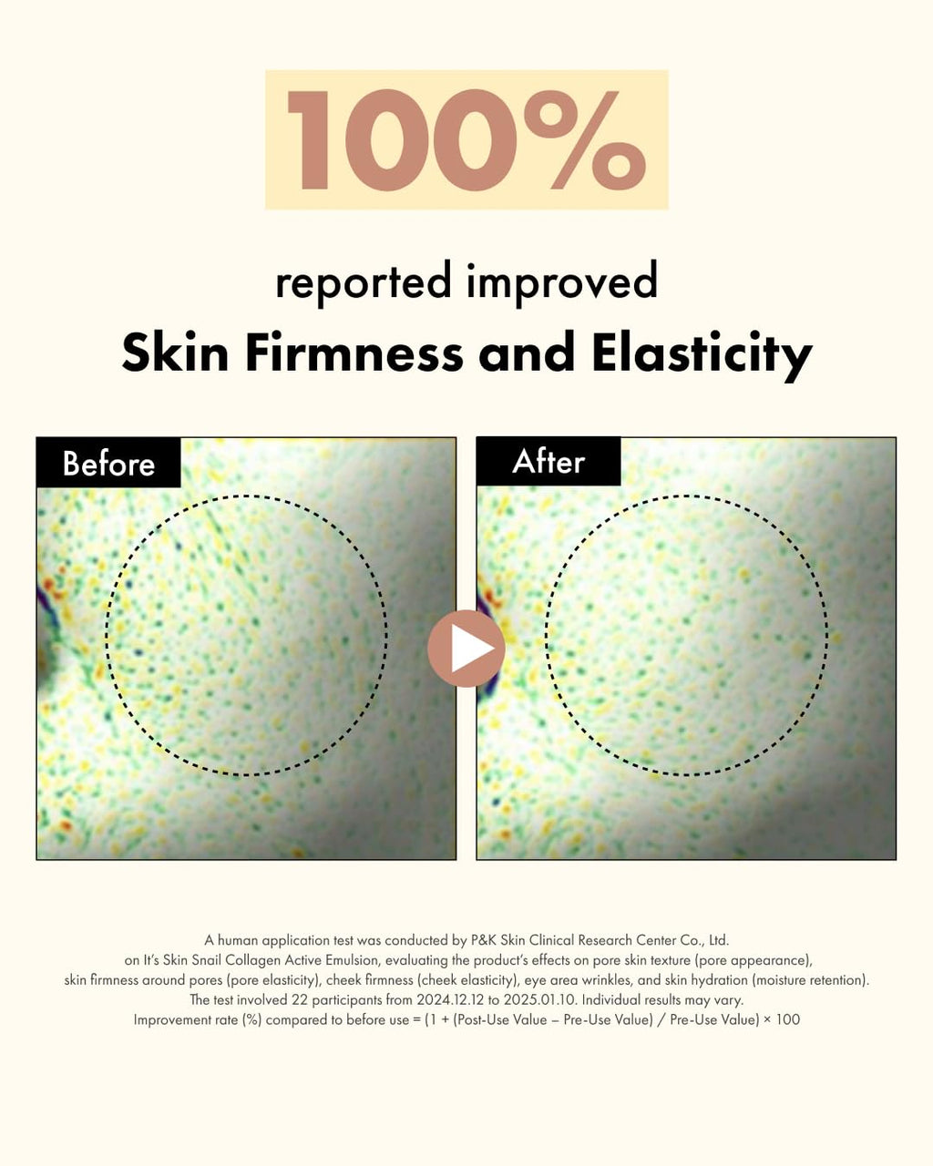It'S SKIN Active Snail Collagen Cream – Firming, Non-Greasy Moisturizer with Snail Mucin