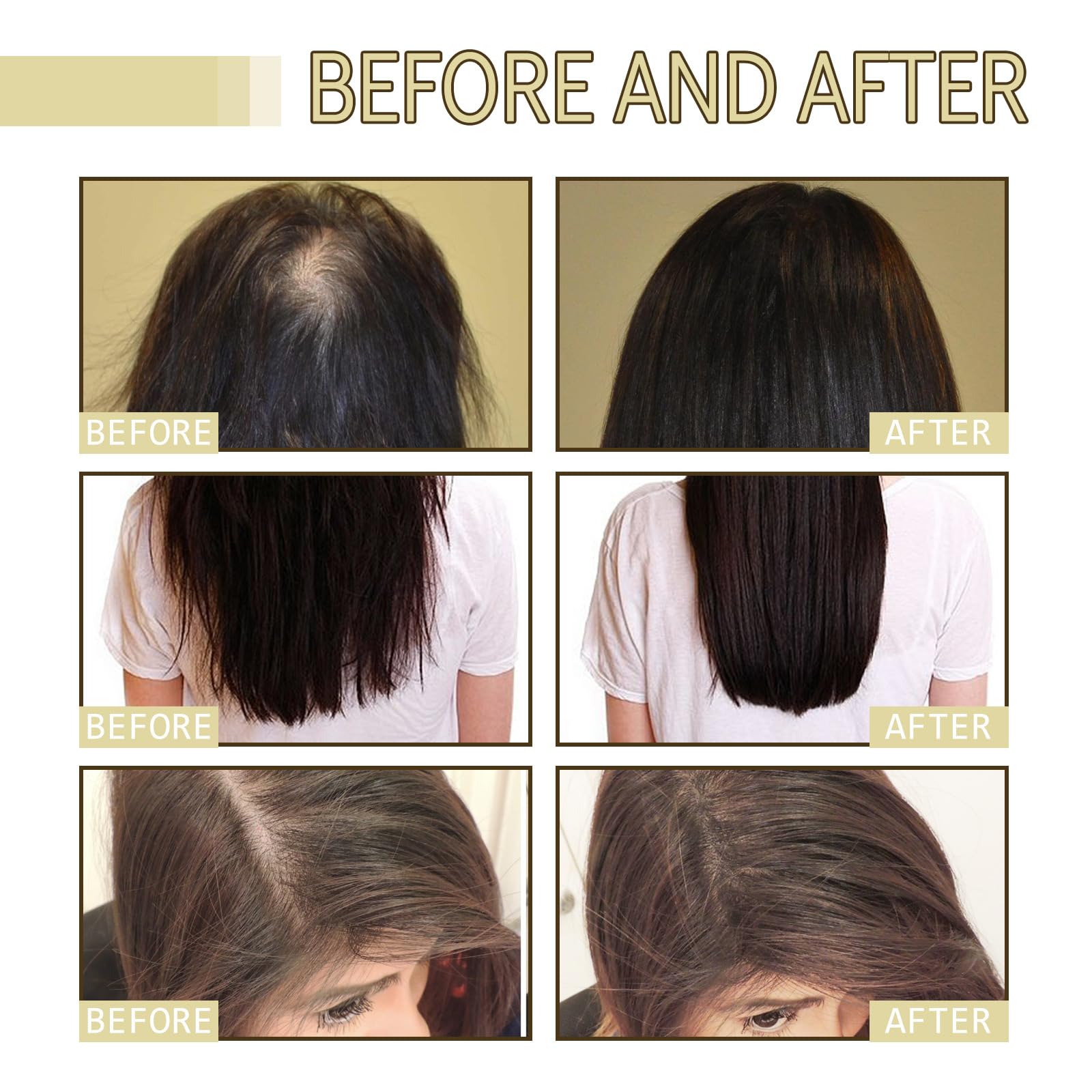 JISKG 180 ml EELHOE Rosemary Hair Growth Oil – 3-Pack for Dry & Damaged Hair