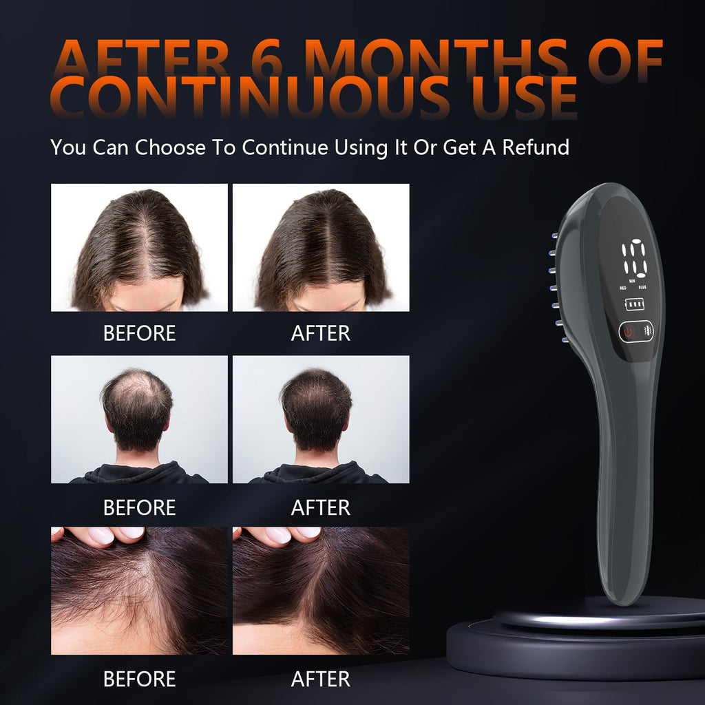 Jitesy Laser Therapy Hair Growth Comb – Red Light Therapy for Hair Growth at Home