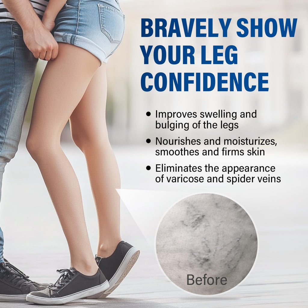 Josera Varicose Veins Cream for Legs – Soothing Relief & Smoother Skin (2 x 20 g)