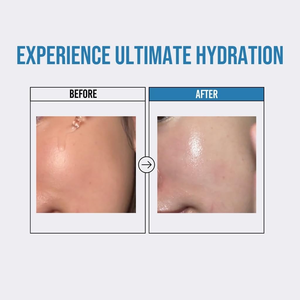 JUMISO Waterfull Hyaluronic Acid Serum – Hydrating Facial Serum for All Skin Types | Vegan, Fragrance-Free | 50 ml