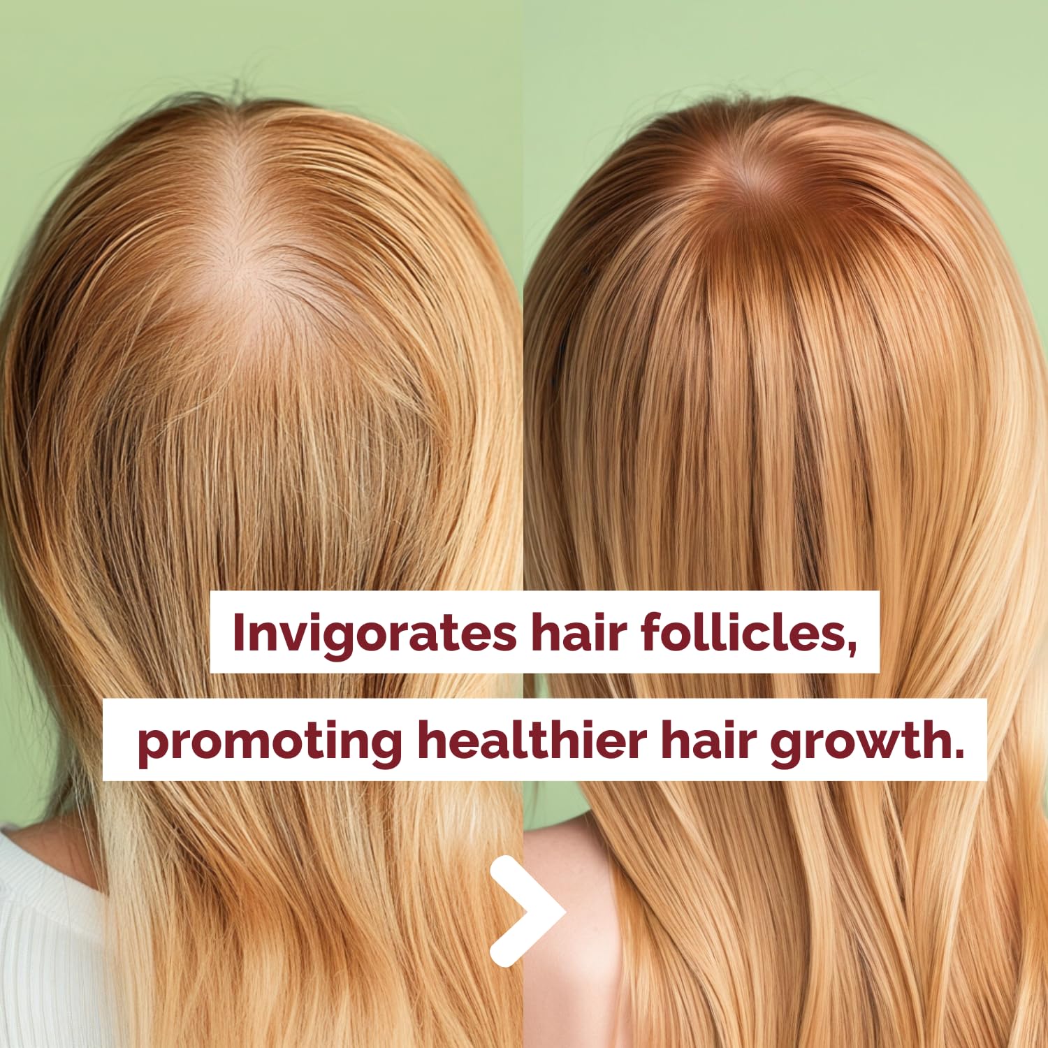 Just Nutritive Onion & Rosemary Shampoo – Hair Growth, Thickening & Strengthening | Sulfate-Free 16 oz