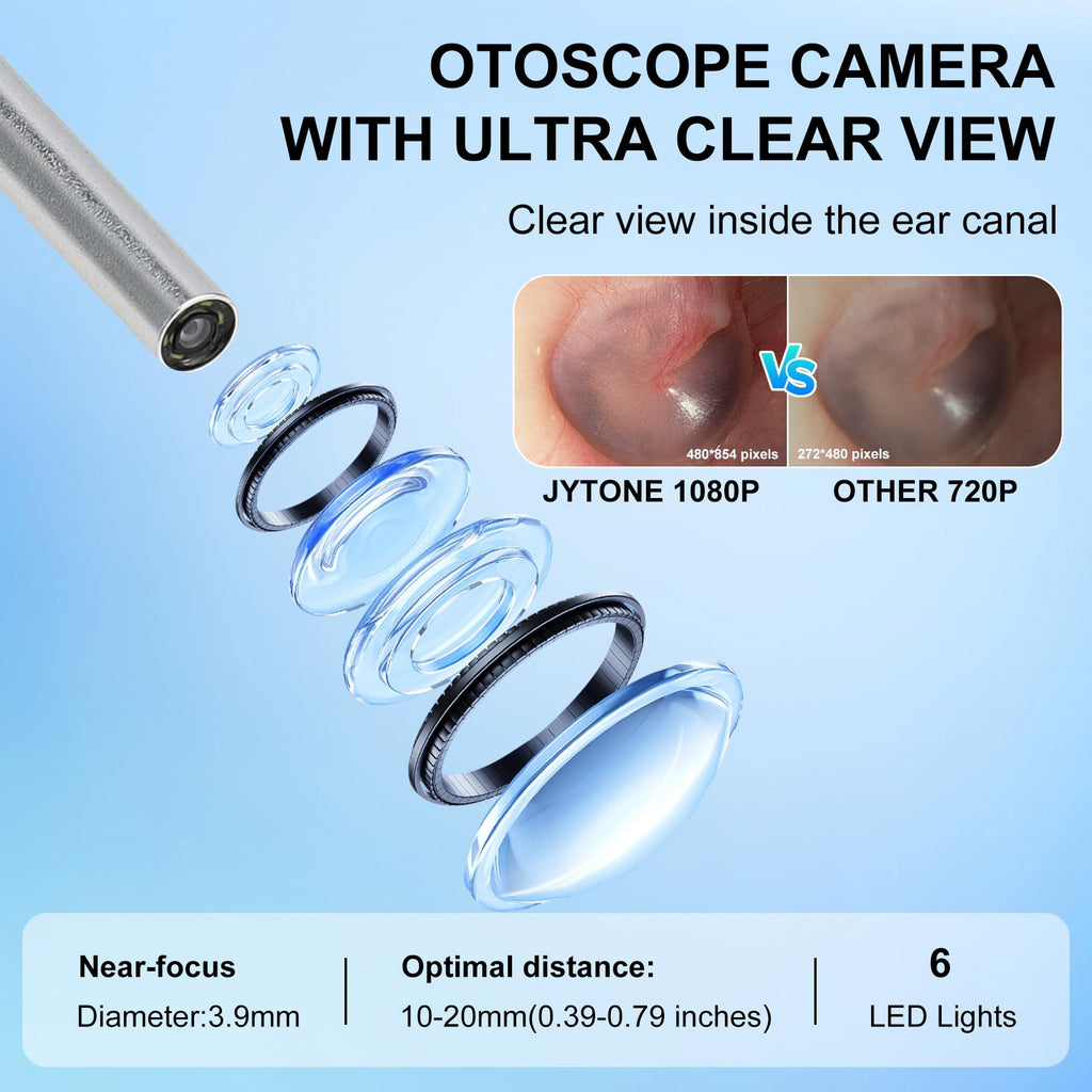 JYTONE Digital Otoscope – 4.5-Inch HD Screen, No App Needed, 3.9mm Probe