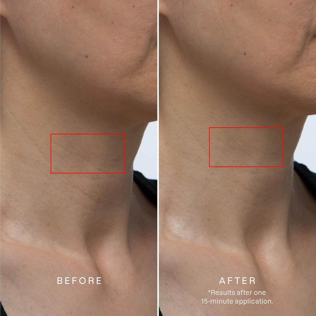 Karuna Collagen Neck & Chest Hydrogel Mask 1-Pack – Firming & Hydrating K-Beauty Mask with Collagen, Peptides & Niacinamide