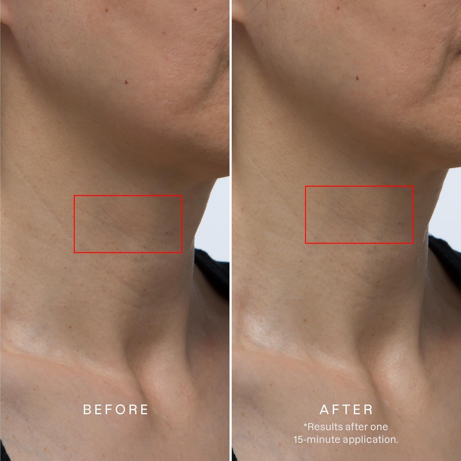 Karuna Collagen Neck & Chest Hydrogel Mask 1-Pack – Firming & Hydrating K-Beauty Mask with Collagen, Peptides & Niacinamide