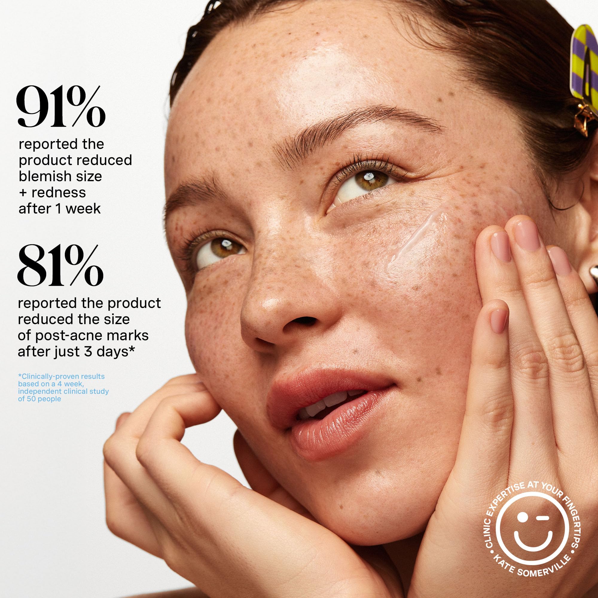 Kate Somerville EradiKate Acne Mark Fading Gel – Salicylic Acid Acne Treatment, 1 Fl Oz