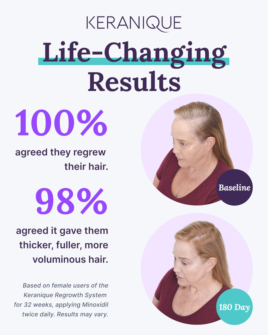 Keranique Hair Growth Set for Women — 2% Minoxidil, Deep Hydration Shampoo & Conditioner, Lift & Repair Spray