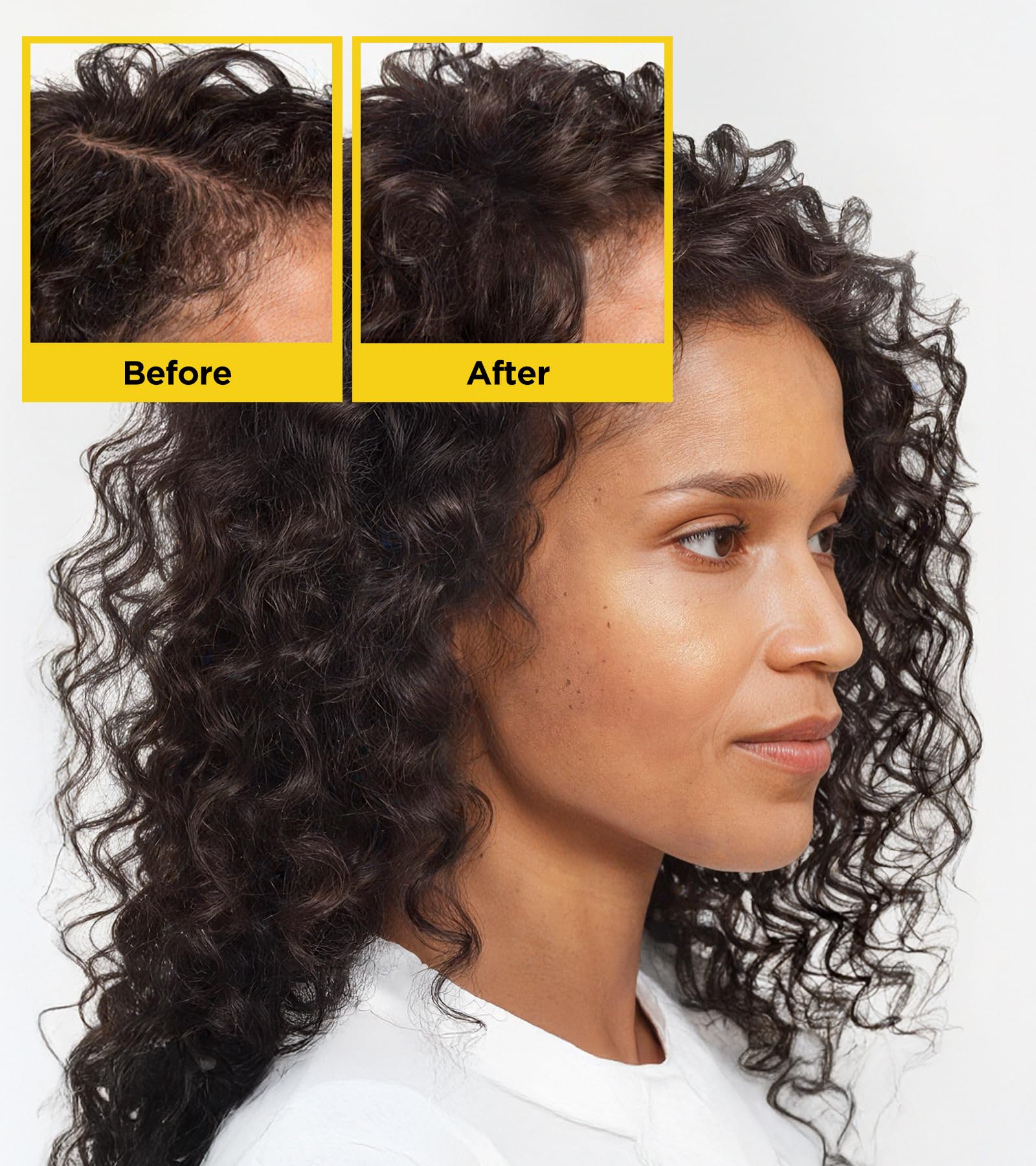 KGUSIS Root Activator Biotin Hair Growth Shampoo – Sulfate Free with Rosemary and Batana Oil