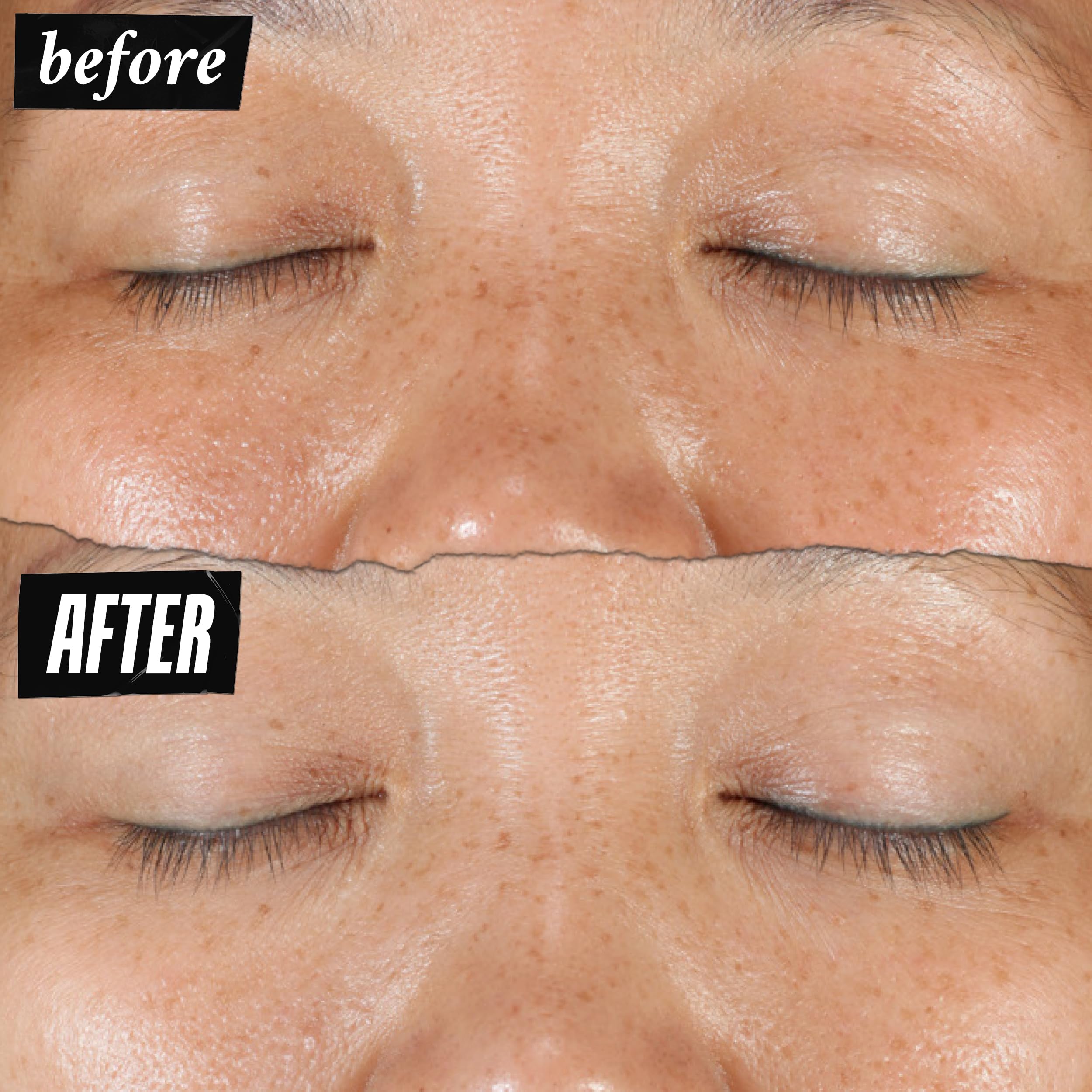 Kiehl's Clearly Corrective Dark Spot Serum | Brightening Facial Serum for Even Skin Tone