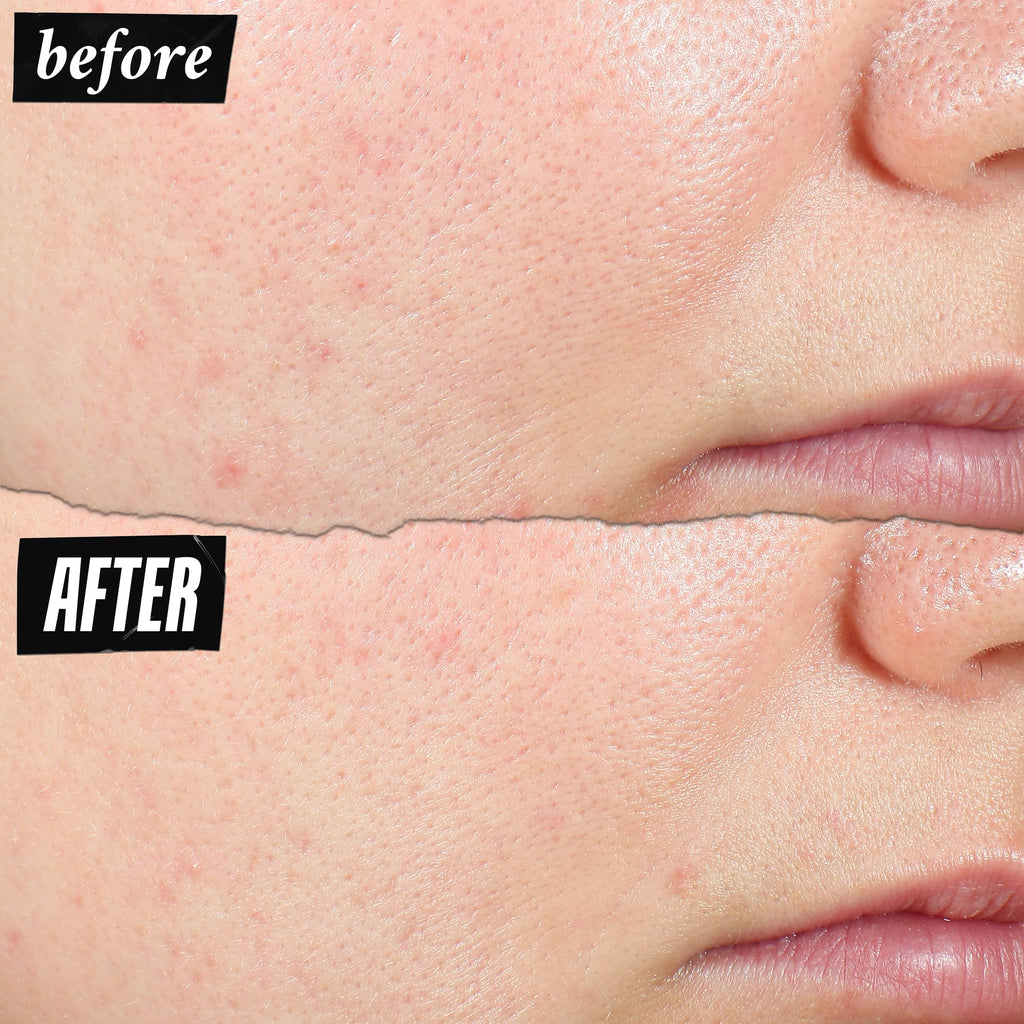 Kiehl's Expertly Clear Moisturizer with 1.2% Salicylic Acid & 2% Niacinamide (2 fl oz)