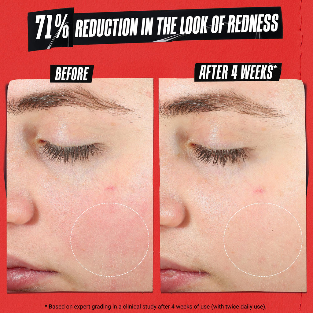 Kiehl's Ultra Facial Recovery Barrier Cream – Lightweight Moisturizing for Dry & Sensitive Skin