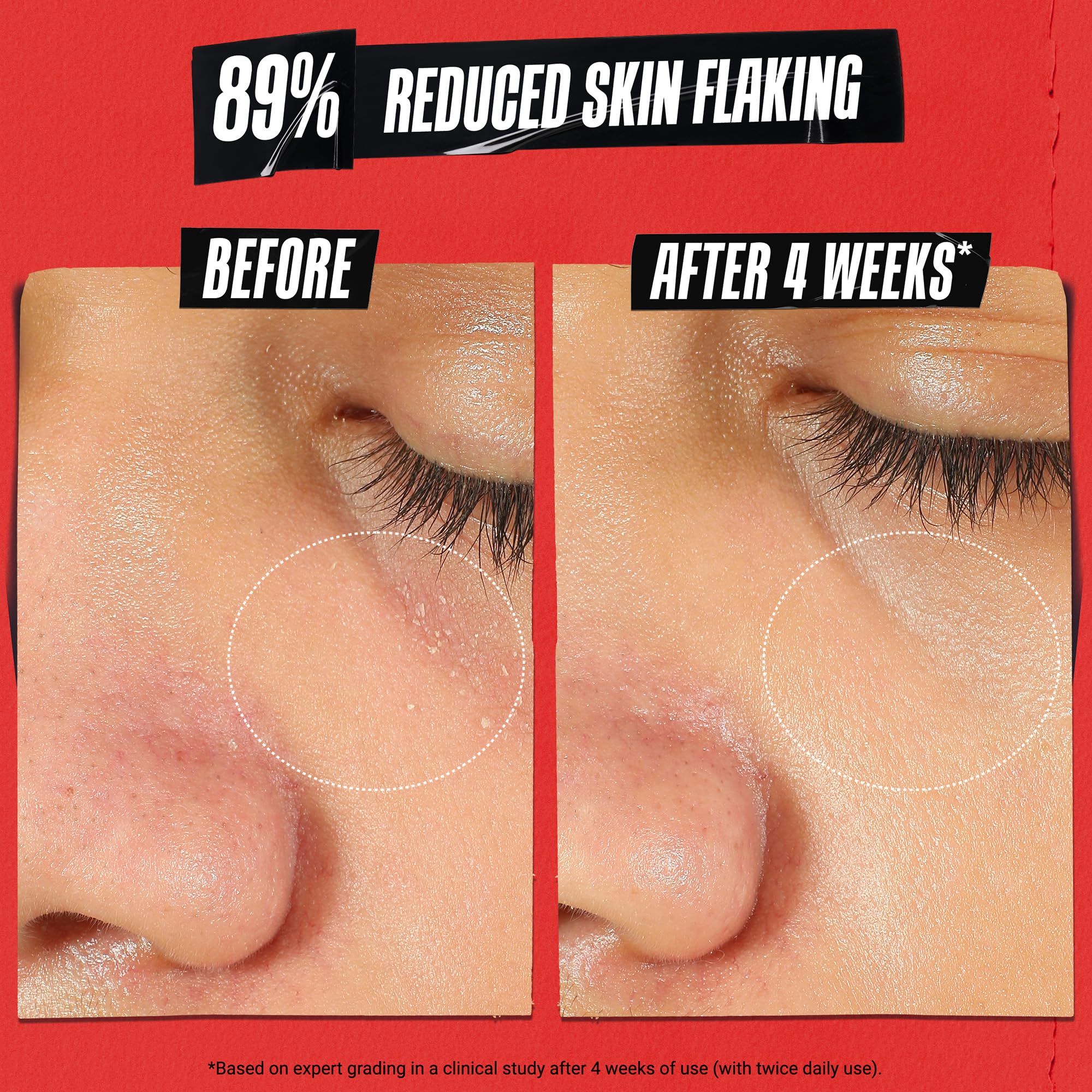 Kiehl's Ultra Facial Recovery Barrier Cream – Lightweight Moisturizing for Dry & Sensitive Skin