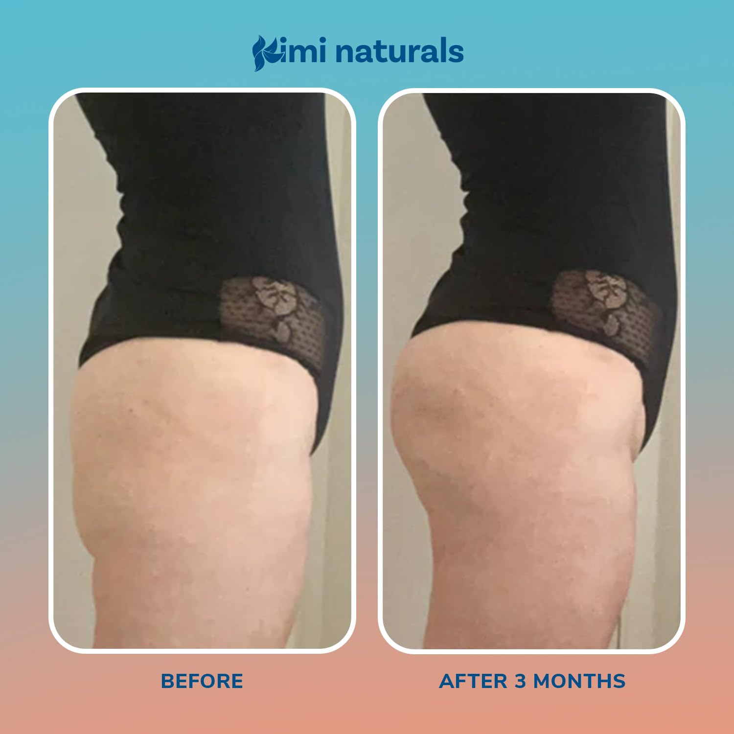 KIMI Naturals Curvy Peaches Butt Enhancement Cream – Fast Growth & Firming (4 oz)