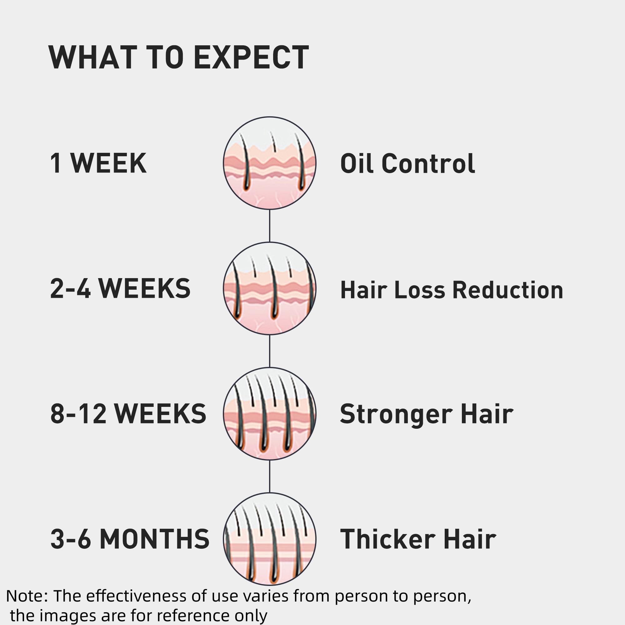 KINTOR 0.9% KX-826 Hair Regrowth Spray – Supports Healthy Hair Growth & Oil Control | 60ml