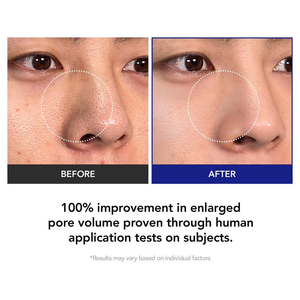 KIOSKIN Toner Pads – 35% Smaller Pores, 32% Reduced Pore Area, CICA Exosomes, AHA/BHA/PHA