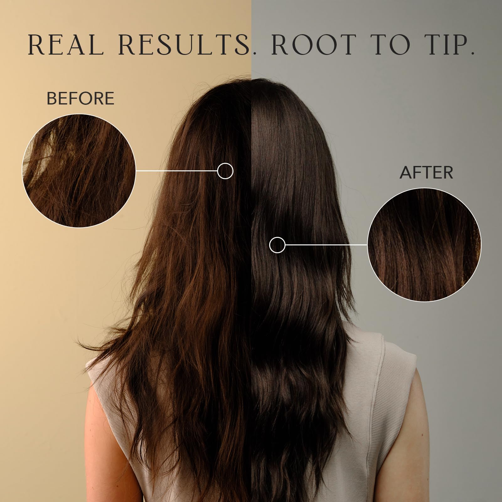 KIWABI Root Beaute Itchy Scalp Shampoo – Sulfate-Free, pH-Balanced Scalp Care