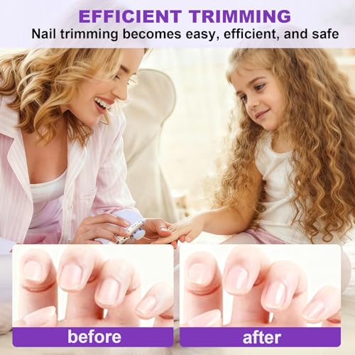 Kiwtreby Electric Nail Clipper 2-in-1: Gentle Trim & Polish for All Ages